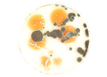 Orange Mold in Petri Dish Identified