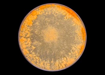 Orange and Black Mold in Petri Dish