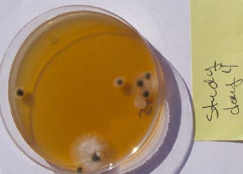 Orange and Black Mold in Petri