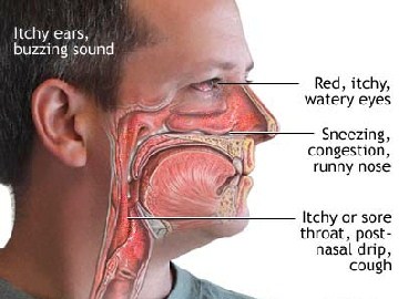 Side effects of breathing in mold