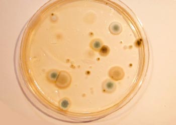 Orange and Black Mold in Petri Dish Identified Pics