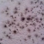 Pictures Of Black Mold on Walls